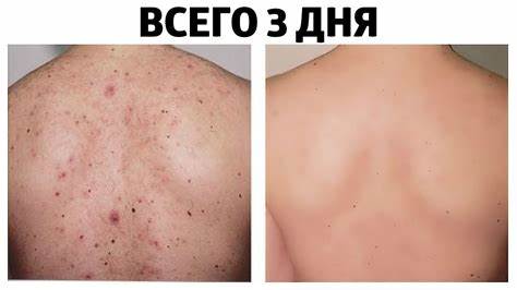 Как убрать жиры боков и живота