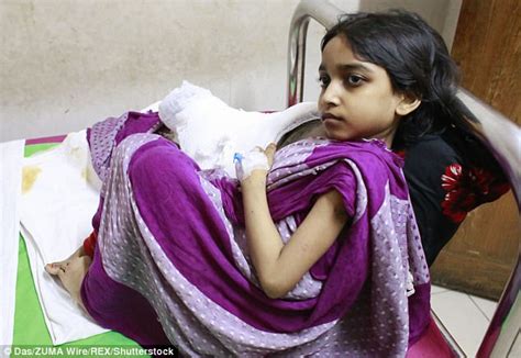 Bangladeshi Girls Battle With Tree Man Disease Daily Mail Online