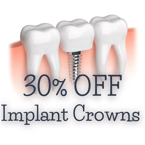 Dental Implant Cost In South Bay Area Save 30 Promotion
