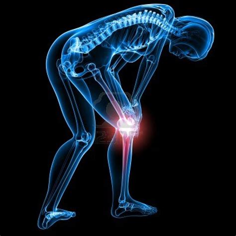 Knee Pain Relief Get Rid Of Knee Pain