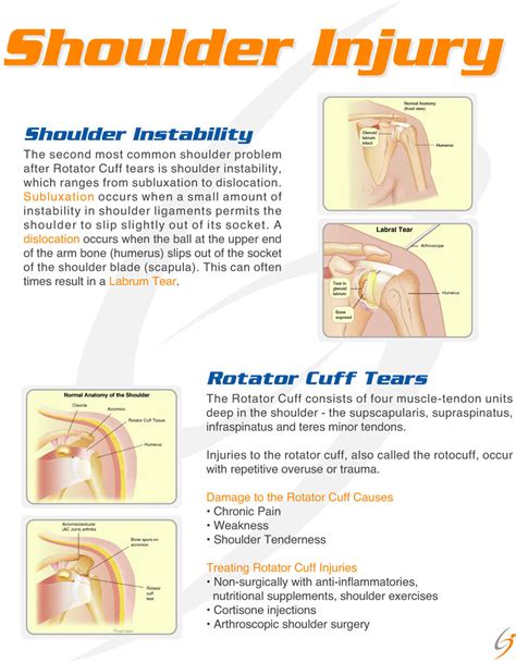 Shoulder Injury Sanders Clinic