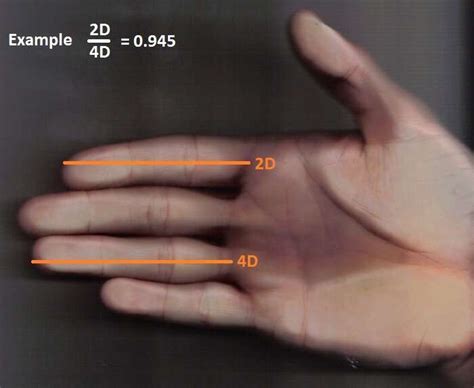 2d4d Ratio Is Not Related To Sex Determined Finger Size Differences In