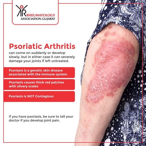 Psoriatic Arthritis Psoriatic Psoriatic Arthritis Psoriasis Causes