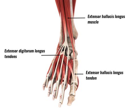 Exercises For Extensor Tendonitis In Foot Exercise Poster
