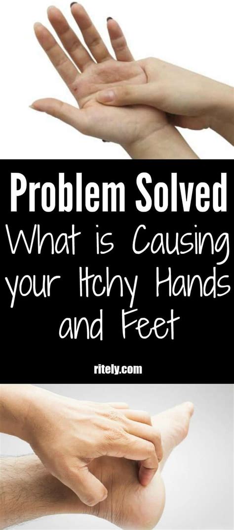 Problem Solved What Is Causing Your Itchy Hands And Feet Itchy Hands Itchy Feet Remedy Hands