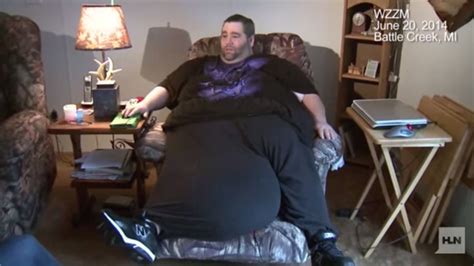 Man With 100 Pound Scrotum In California For Crowd Funded Surgery Fox News