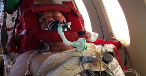 Plane Crash Victim Survives Horrific Burns Vows To Create