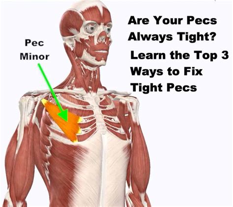 Tight Pec Minor The Doctors Of Physical Therapy