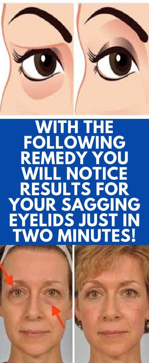 With The Following Remedy You Will Notice Results For Your Sagging
