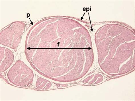 Histology Of The Peripheral Nerve Showing The Nerve Fascicles F