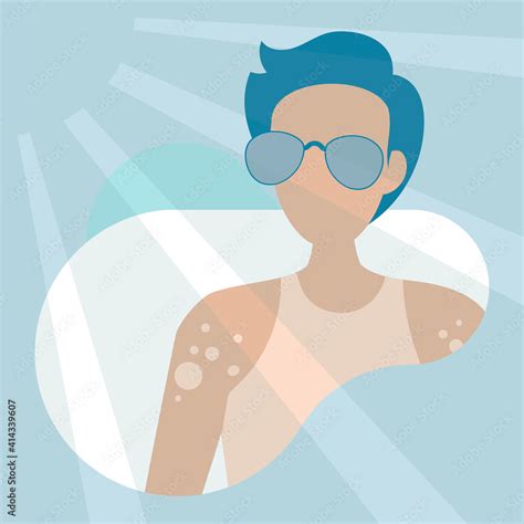 Man With Skin Cancer Character Vector Stock Vector Adobe Stock