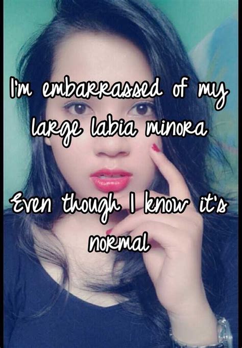 I M Embarrassed Of My Large Labia Minora Even Though I Know It S Normal