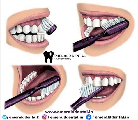 WHY CORRECT BRUSHING TECHNIQUE IS IMPORTANT ! - EMERALD DENTAL