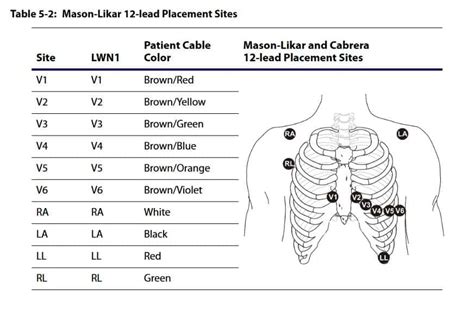 15 Lead Ecg Placement Diagram Verbalcopernicus