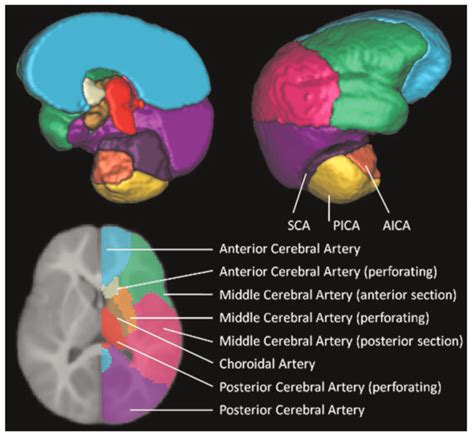 Arterial Territories Of The Neonatal Brain Download Scientific Diagram
