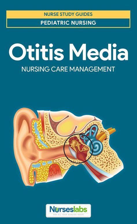 Otitis Media Nursing Care Planning And Management Study Guide Otitis