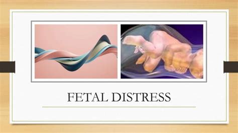 Fetal Distress Pptx