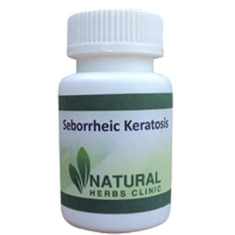 Seborrheic Keratosis Symptoms And Treatments Herbal Treatment