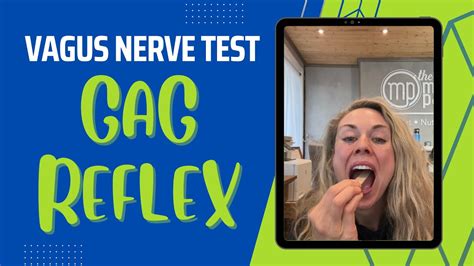 Vagus Nerve Test Gag Reflex Youtube