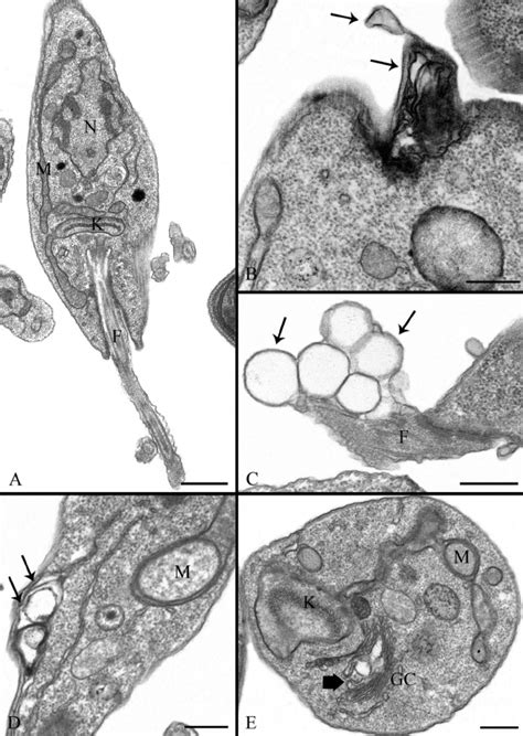 Ultrathin Sections Of Promastigote Forms Of Leishmania Amazonensis Download Scientific Diagram