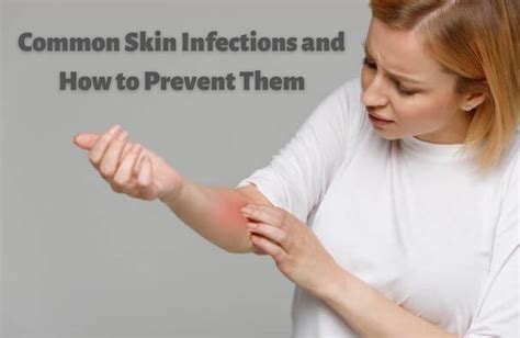 Common Skin Infections And How To Prevent Them