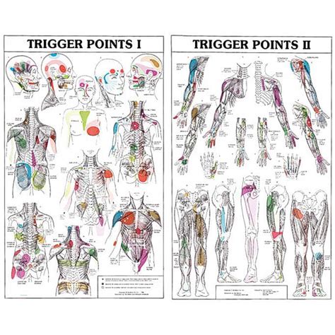 Trigger Points I And Ii Chart Laminated Walmart