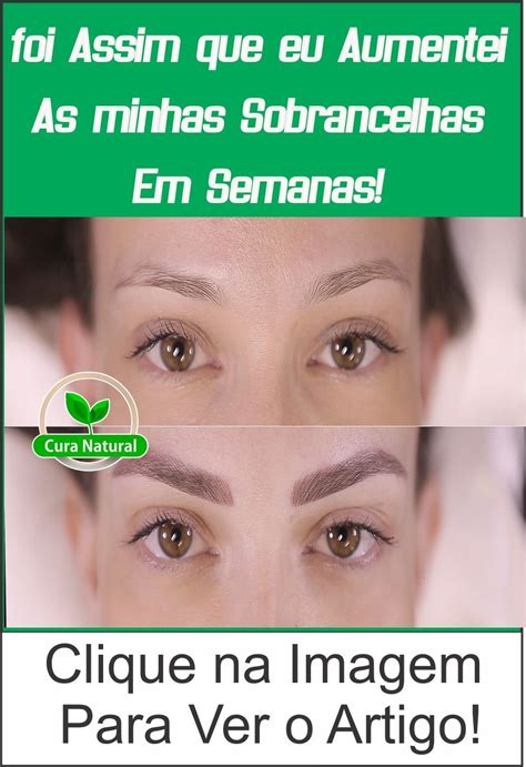 Como Fazer A Sobrancelha Crescer Em 1 Dia