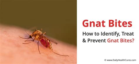 Gnat Bites How To Identify And Treat Them Daily Health Cures