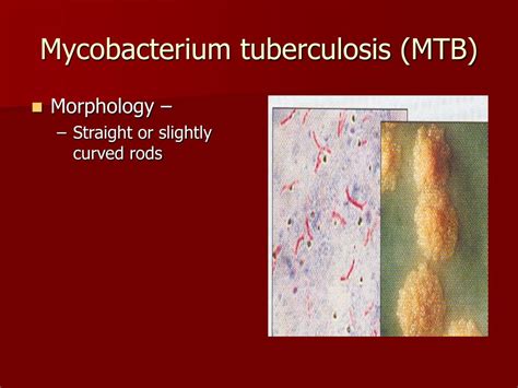Ppt Mycobacteria Powerpoint Presentation Free Download Id3338963
