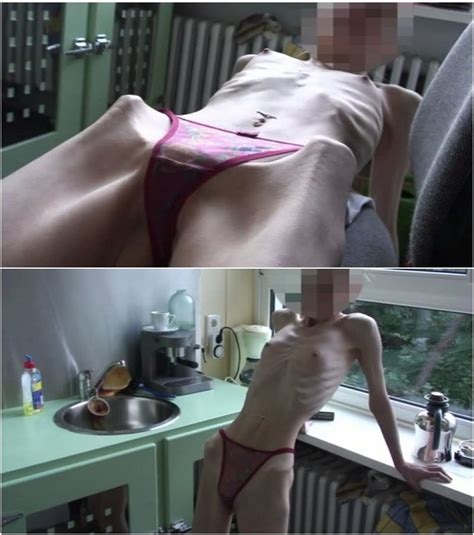Extremely Skinny And Anorexic Softcore Posing Women Videos Page