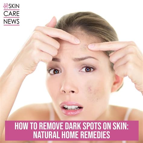 How To Remove Dark Spots On Skin Natural Home Remedies Skin Care Top