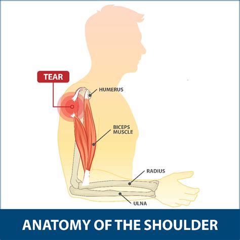 Biceps Tendon Anatomy Shoulder Palpation Of Subscapularis Tendon