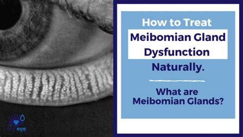 How To Express Meibomian Glands At Home What Is A Meibomian Gland