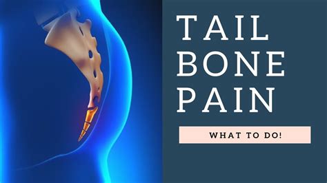 Addressing Tail Bone Pain Coccydynia Coccyx Pain Youtube