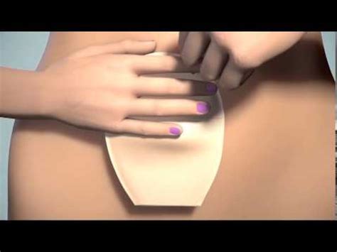 Check spelling or type a new query. Applying a 1 Piece Stoma Bag - YouTube