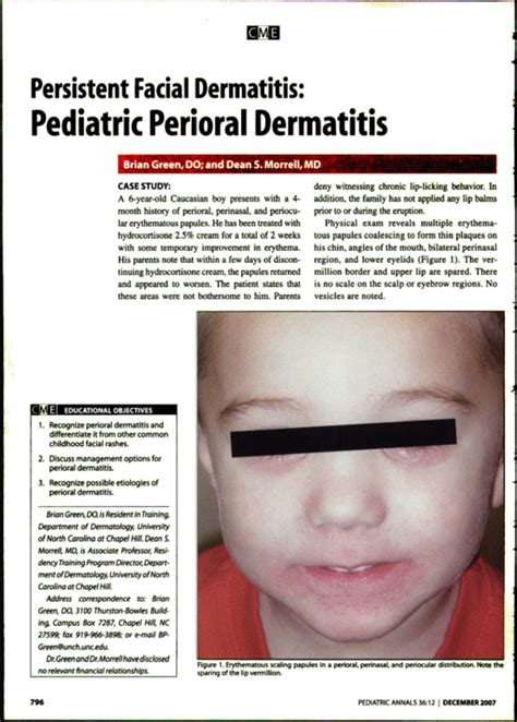Persistent Facial Dermatitis Pediatric Perioral Dermatitis Pediatric