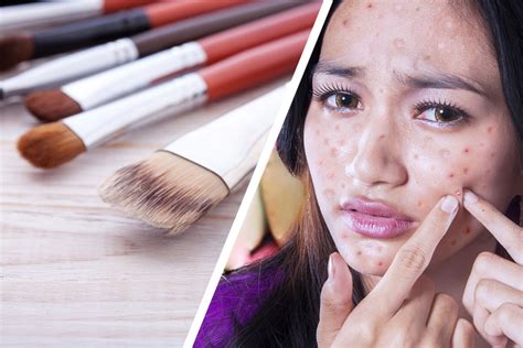 Can Dirty Makeup Brushes Cause Cystic Acne Mugeek Vidalondon