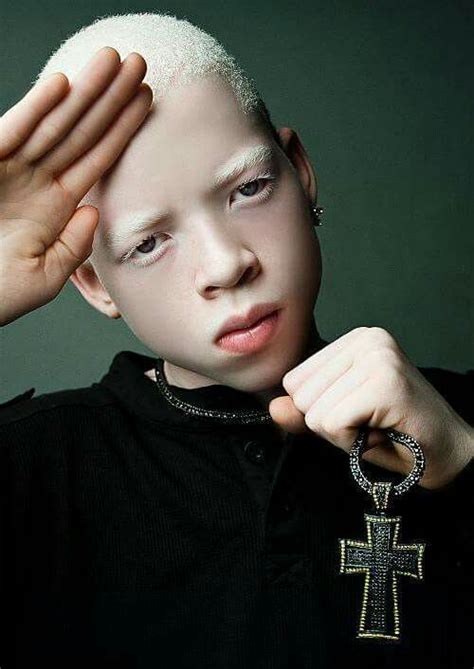 Self Convince Albinism Beauty Beautiful