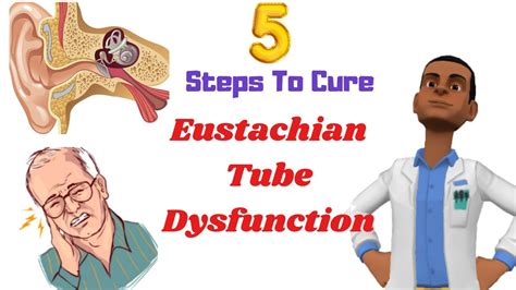 5 Steps To Cure Eustachian Tube Dysfunction Live Healing At Home