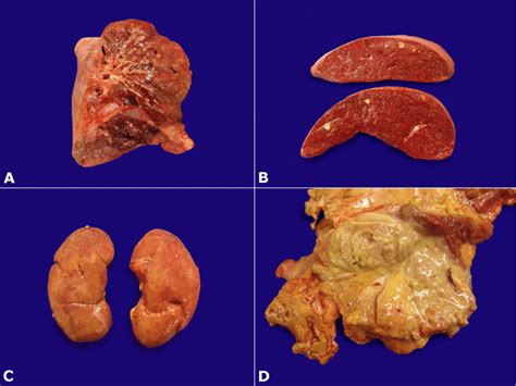 The term 'parenchyma' has originated from the greek word 'para' which means beside and 'enchyma'. Gross examination of: A-Lung parenchyma with nodules ...