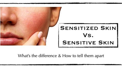 Sensitive Vs Sensitized Skin Skin Type Vs Skin Condition Edition