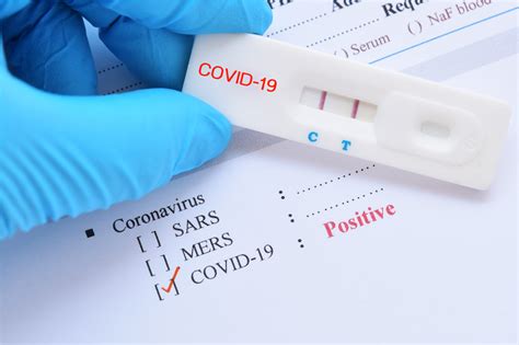 How Long Will I Test Positive For Covid 19 Fundamentals Explained