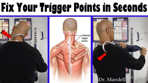 Relieve Your Trigger Points In Seconds And Fix Neck Pain Dr Alan