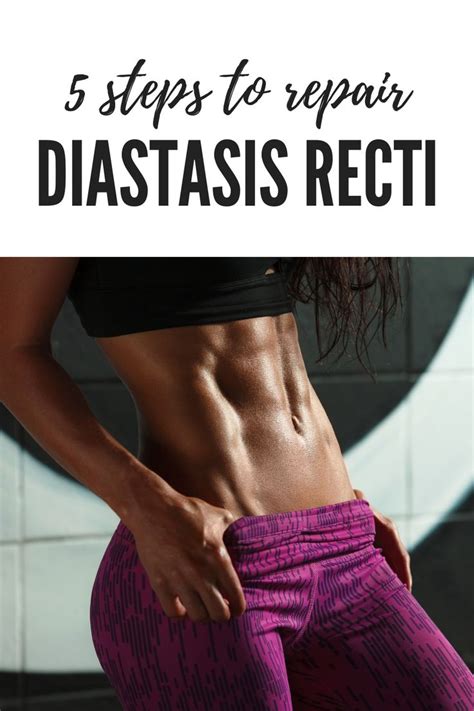 The fibres of the external intercostal muscles originate from the inferior border. Simple steps to fix diastasis recti | Diastasis recti ...