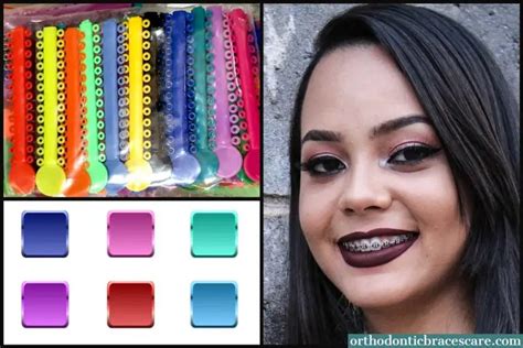Best Braces Color For Light Skin How To Choose Orthodontic Braces Care