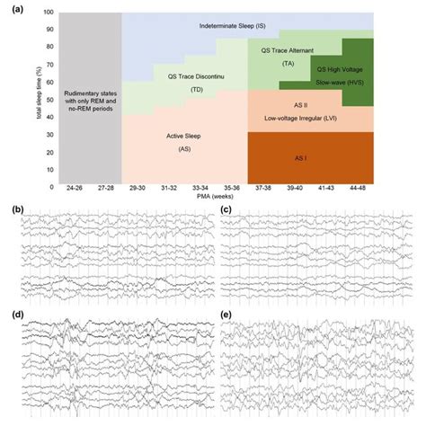 6,143 likes · 118 talking about this. A faction of a phone lattice and a speech segment X ...