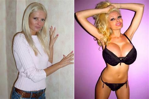 Glamour Model Spends £30k On Plastic Surgery To Look Like A Blow Up Sex
