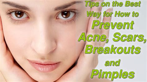 Tips On The Best Way For How To Prevent Acne Scars Breakouts And