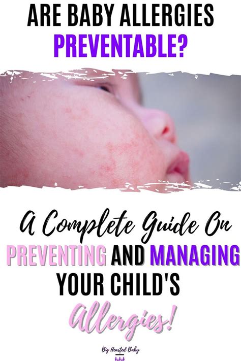Baby Allergies A Complete Guide On Preventing And Managing Your Child