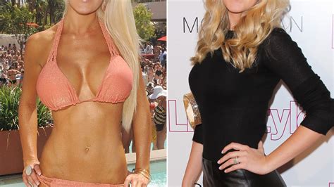 Celebs Whove Removed Their Breast Implants Health